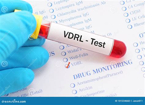 vdrl blood test bottle|vdrl test sensitivity.